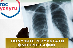  Результаты флюорографии можно получить, не выходя из дома.