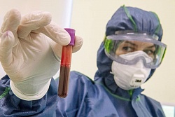 За сутки в Усть-Кутском районе подтвердилось 63 новых случая коронавируса.